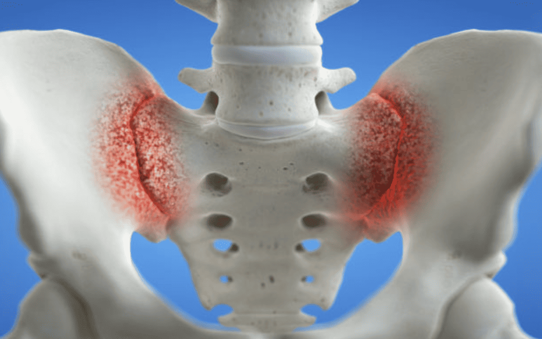 SACROILIAC JOINT PAIN – THE BACK PAIN THAT SLOWS YOU DOWN